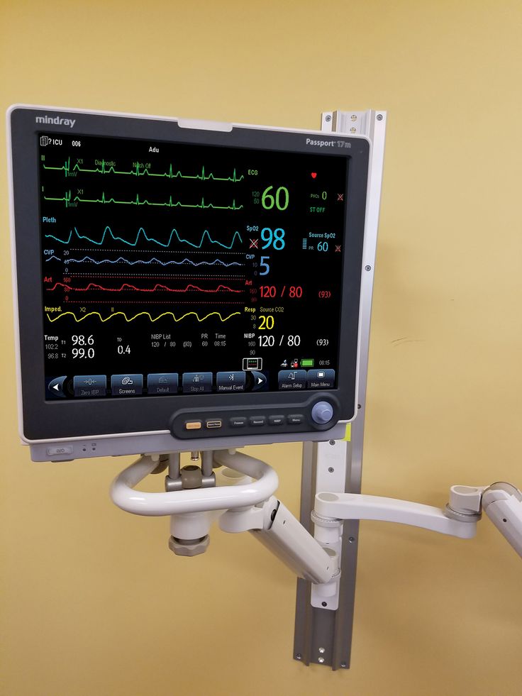 Standard-tier multiparameter patient monitor, within the mid-range patient monitor price in Kenya